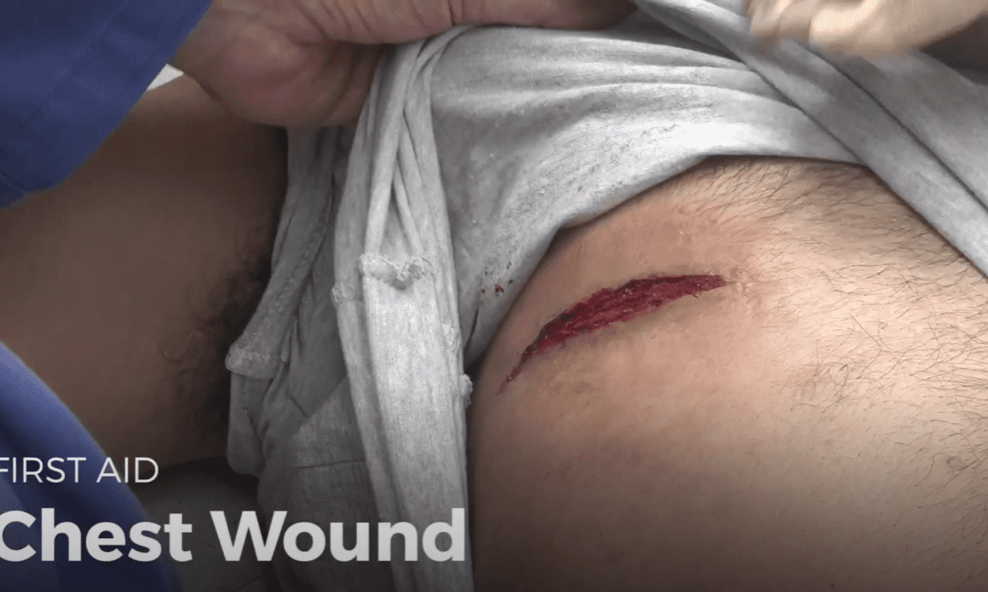 Video: chest wound