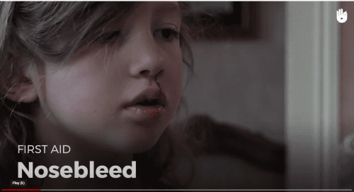 Video: nosebleed