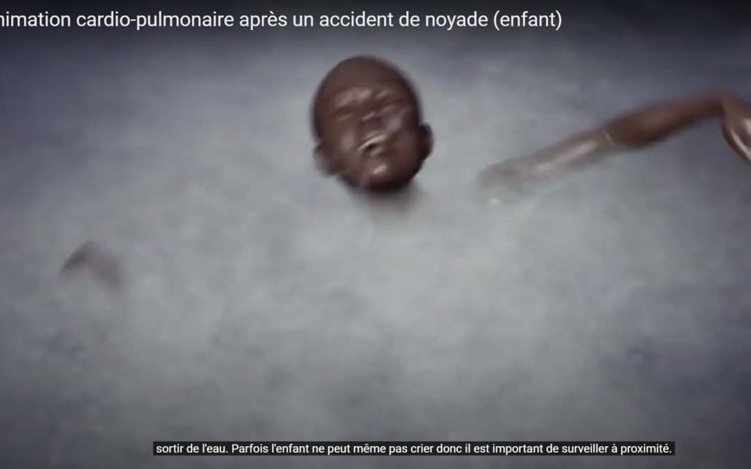 Providing Cardipulmonary resuscitation after a drowning accident of a child
